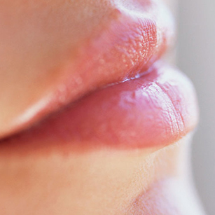 dermal fillers - lips page image - top
