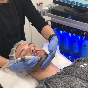 male hydrafacial patient at infinity clinic