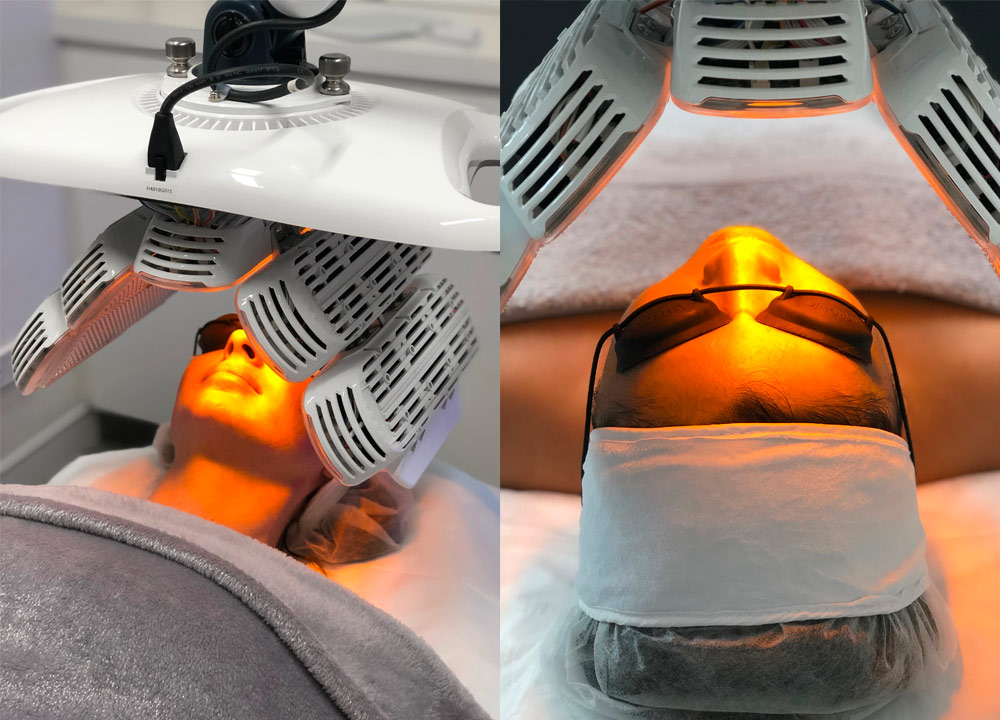 Healite II Treatment - LED phototherapy for skin rejuvenation - patient during session